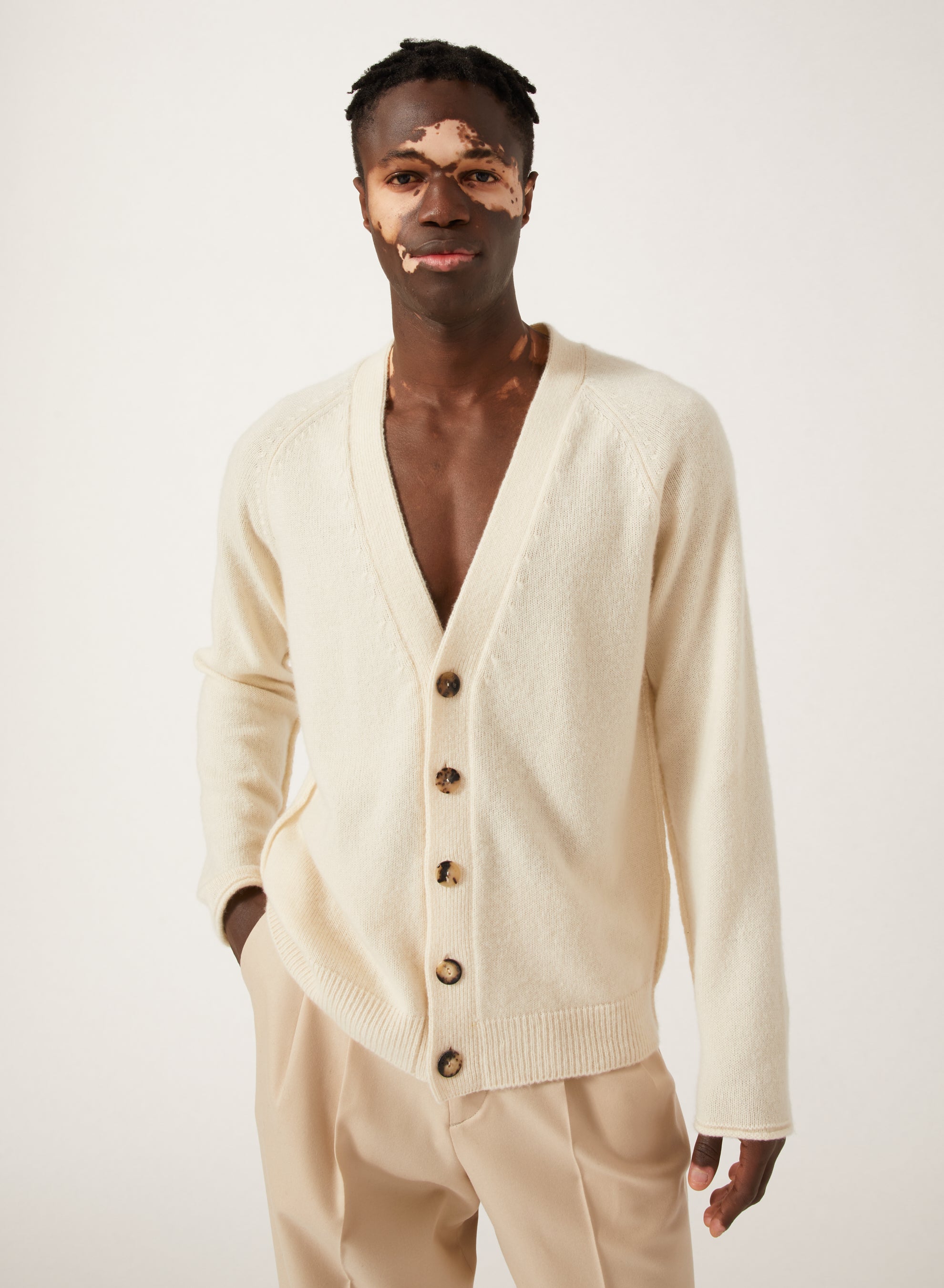 Ivory_1QTY // Gilet à boutons marbrés en laine - Ivory